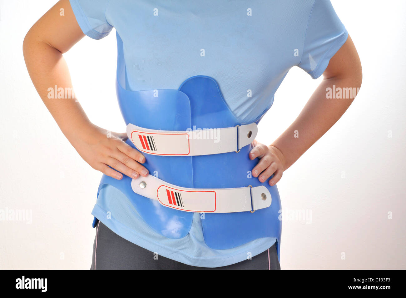 Scolioses corset hi-res stock photography and images - Alamy