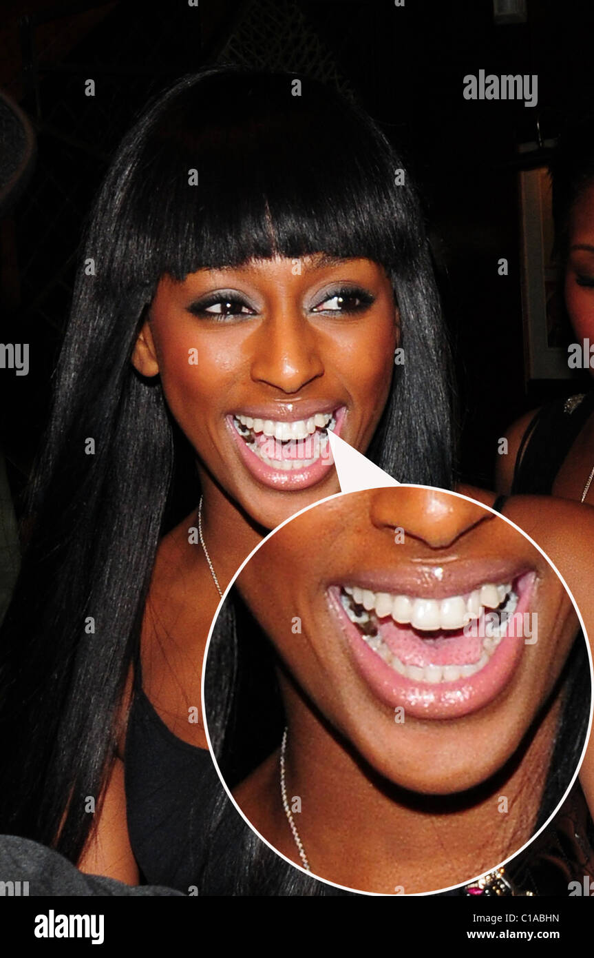 Alexandra Burke Leaves The Ivy Restaurant With Big Smile Showing The Dark Fillings In Her Teeth London England 31 03 09 Stock Photo Alamy