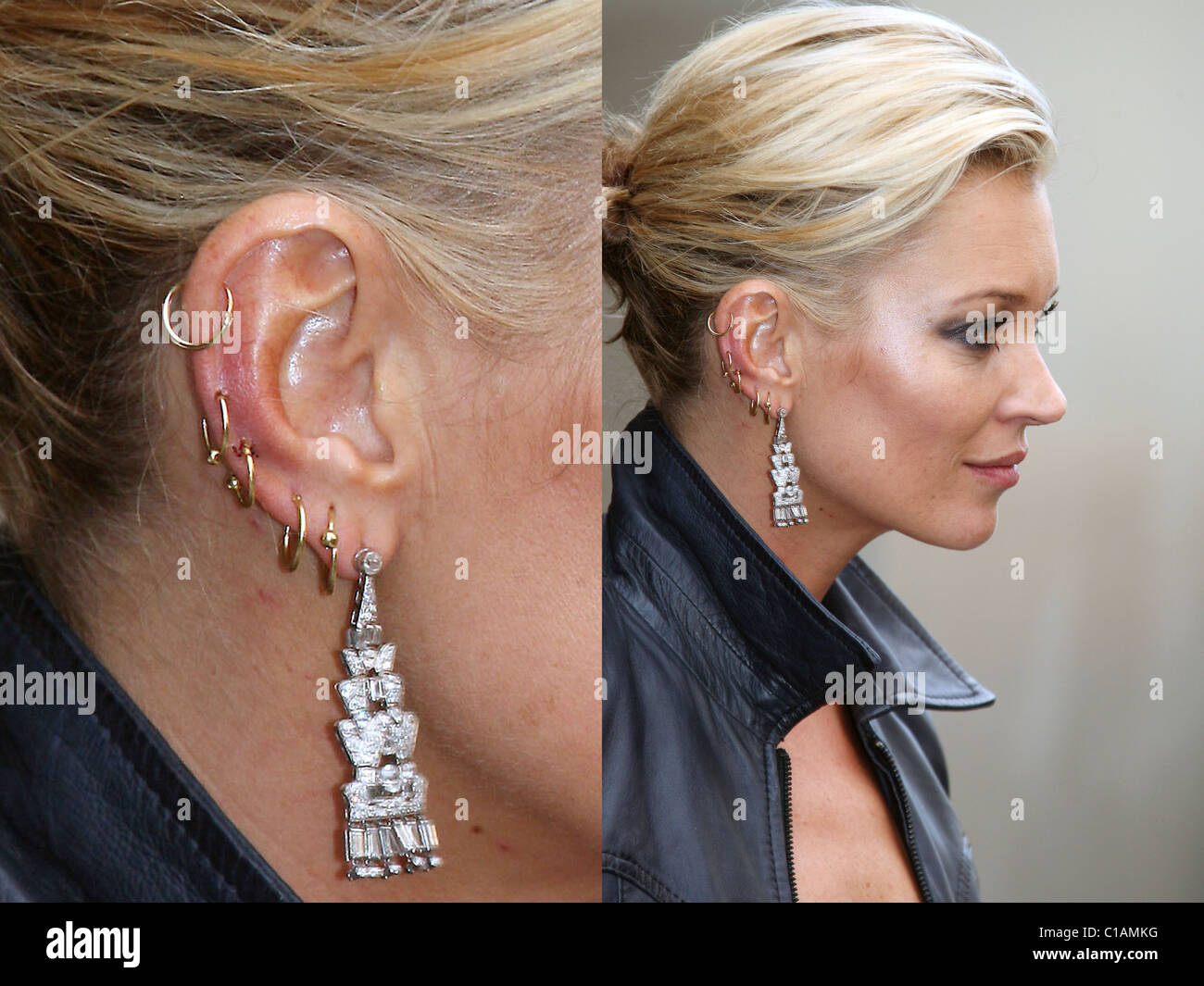 Kate Moss' ear is red and sore looking after she had several Stock Photo -  Alamy