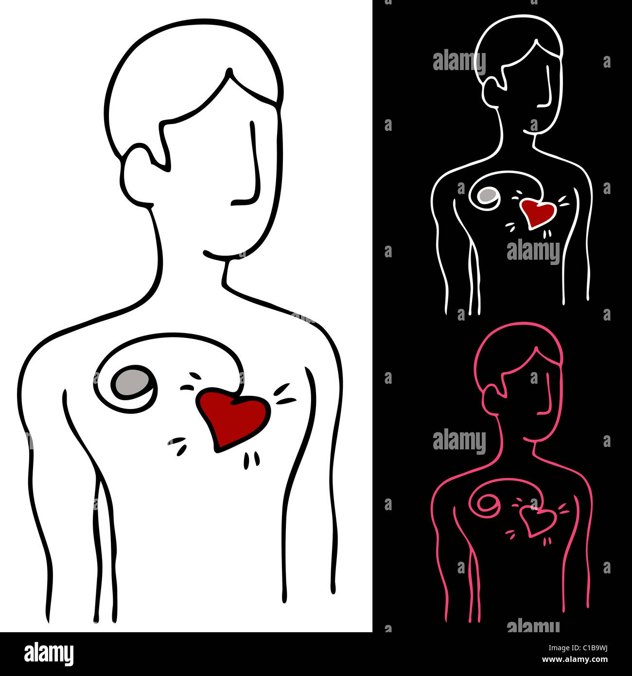 An image of a man with a pacemaker device attached to his heart Stock