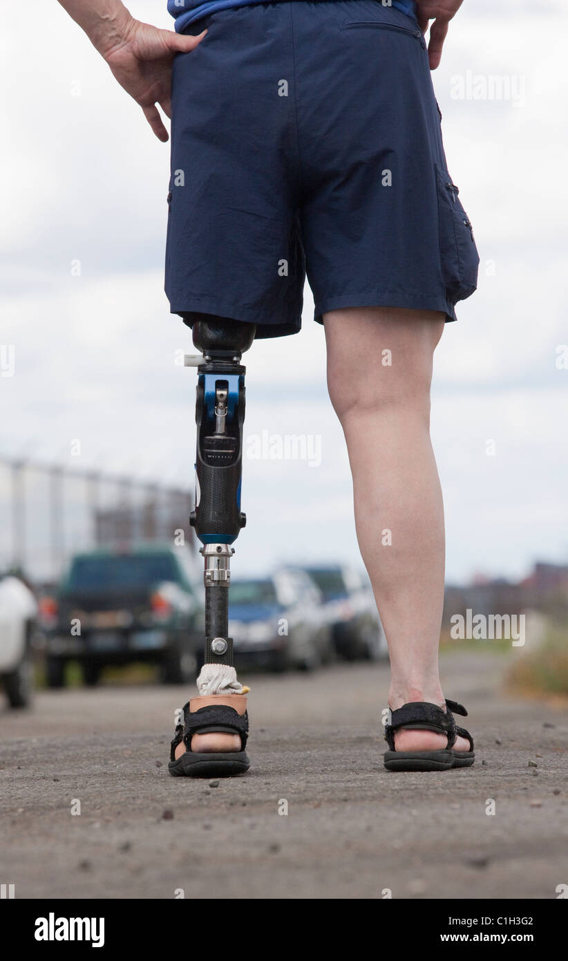 Woman with prosthetic leg standing on the road Stock Photo Alamy