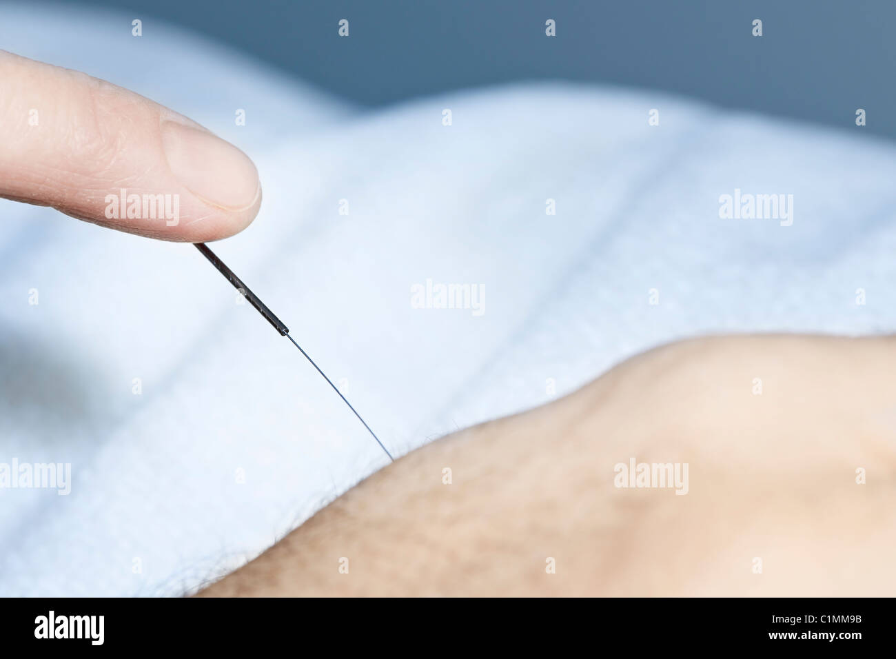 Finger acupressure hires stock photography and images Alamy
