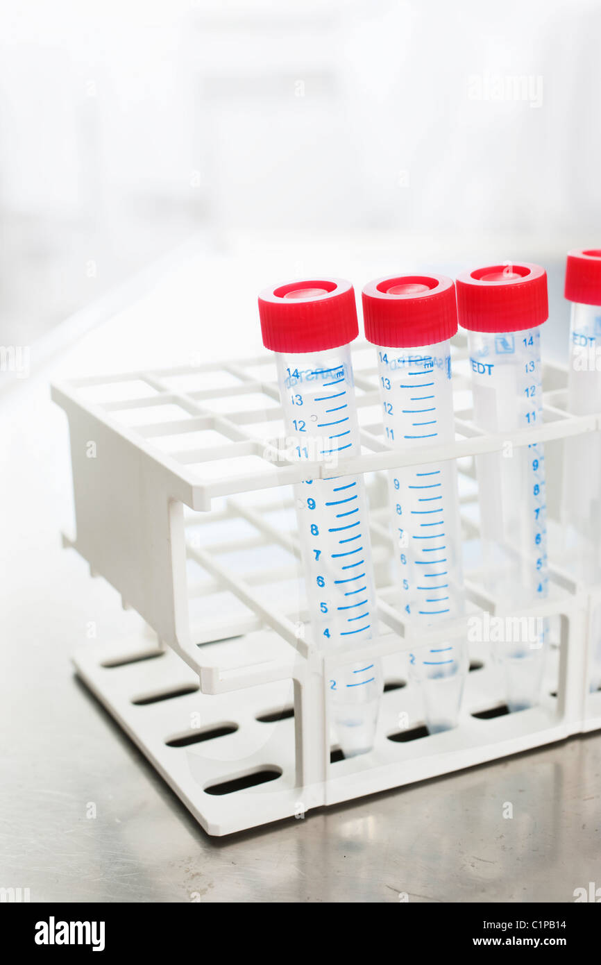 Medical tubes in hospitals hires stock photography and images Alamy