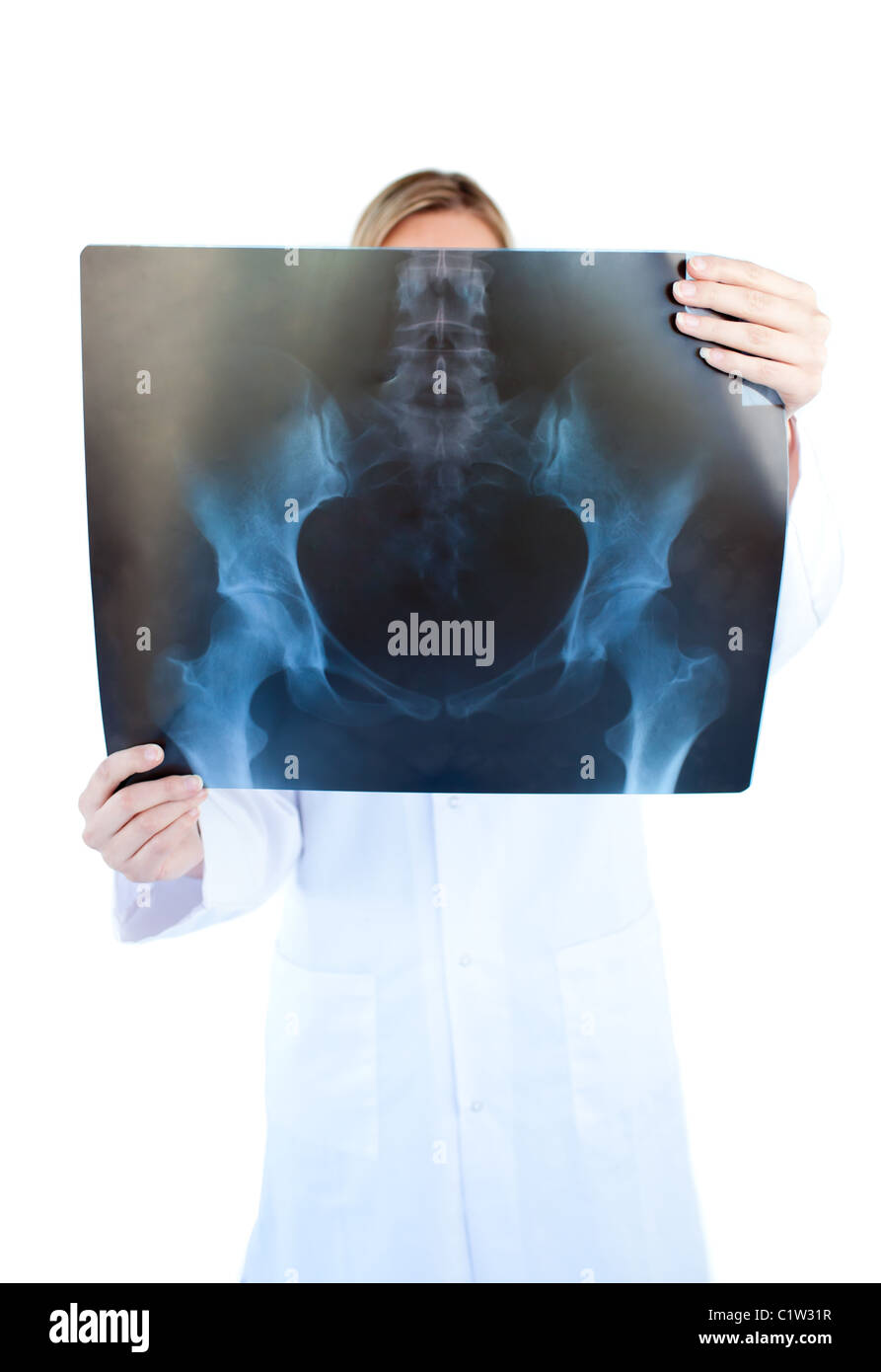 Concentrated female doctor holding a x-ray Stock Photo