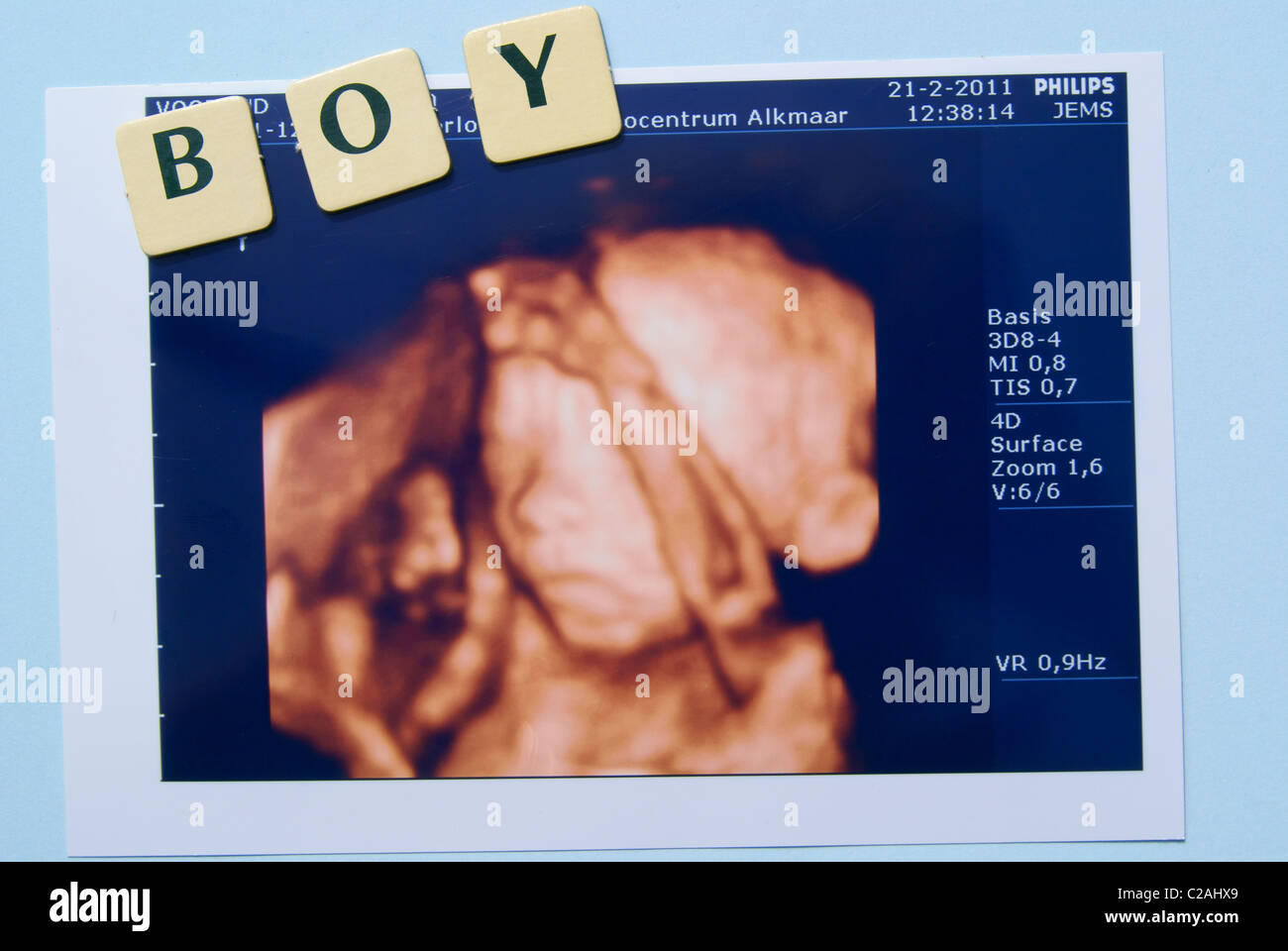 Baby Ultrasound, it is a boy. Stock Photo