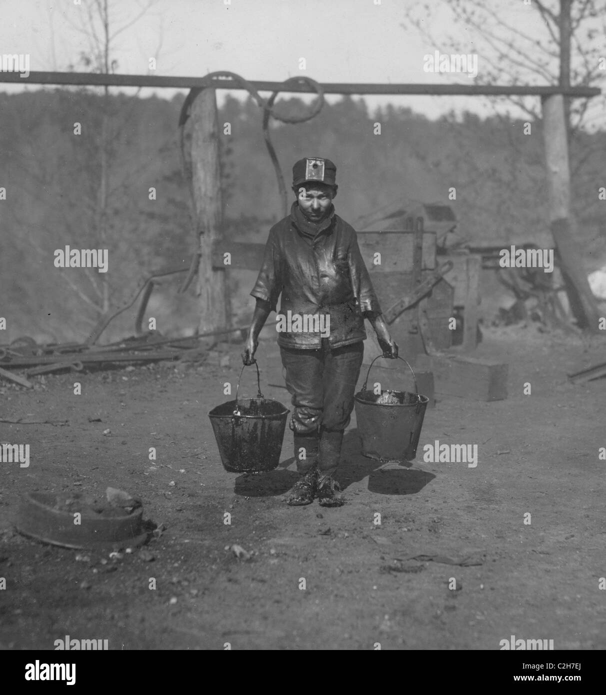 Boy with crushed leg works in the mines. Stock Photo