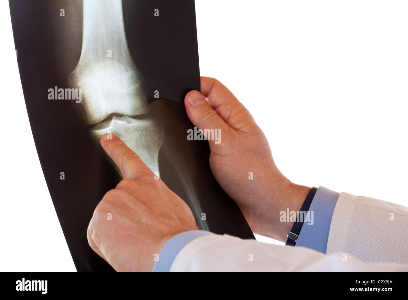 Medical doctor pointing with finger at radiograph of knee joint bone. Isolated on white background. Stock Photo