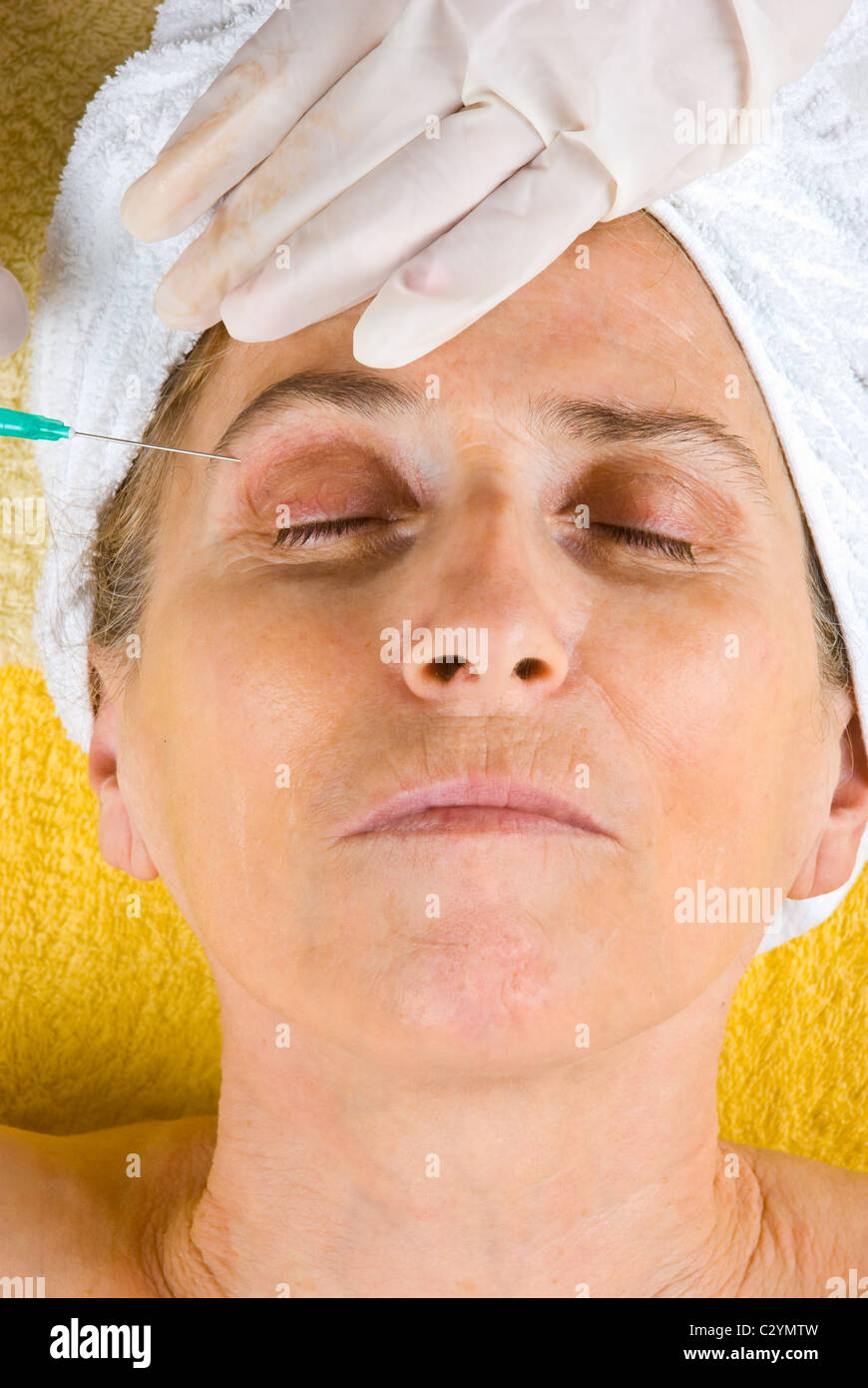 Senior woman being injected with botox in her eyebrows Stock Photo