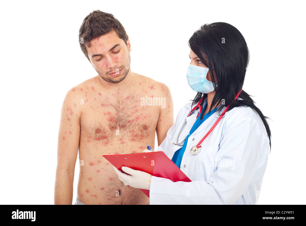 Chickenpox Doctor Woman chicken pox hi-res stock photography and images - Alamy