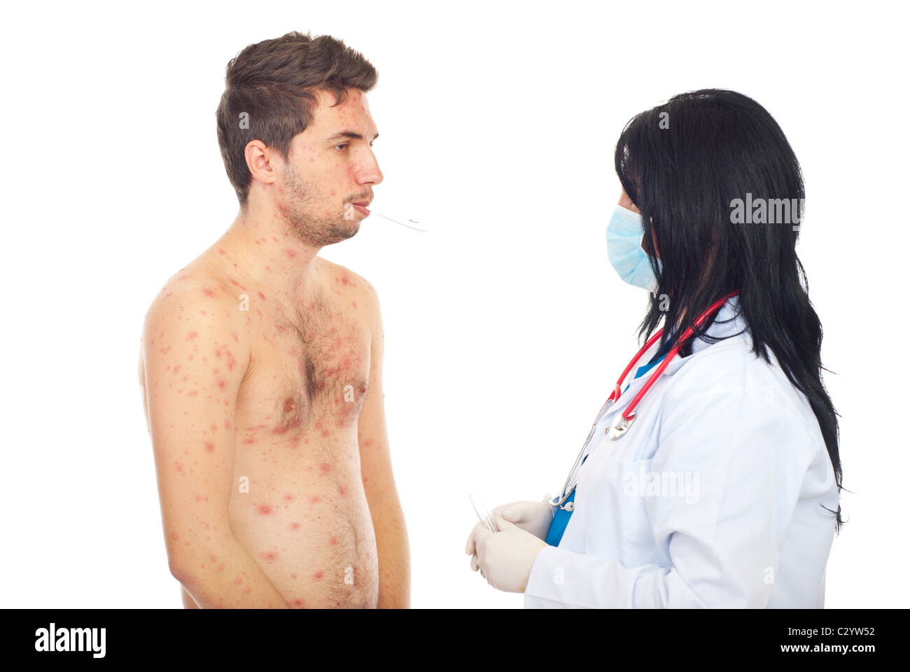 Chicken pox rash on face Cut Out Stock Images & Pictures - Alamy