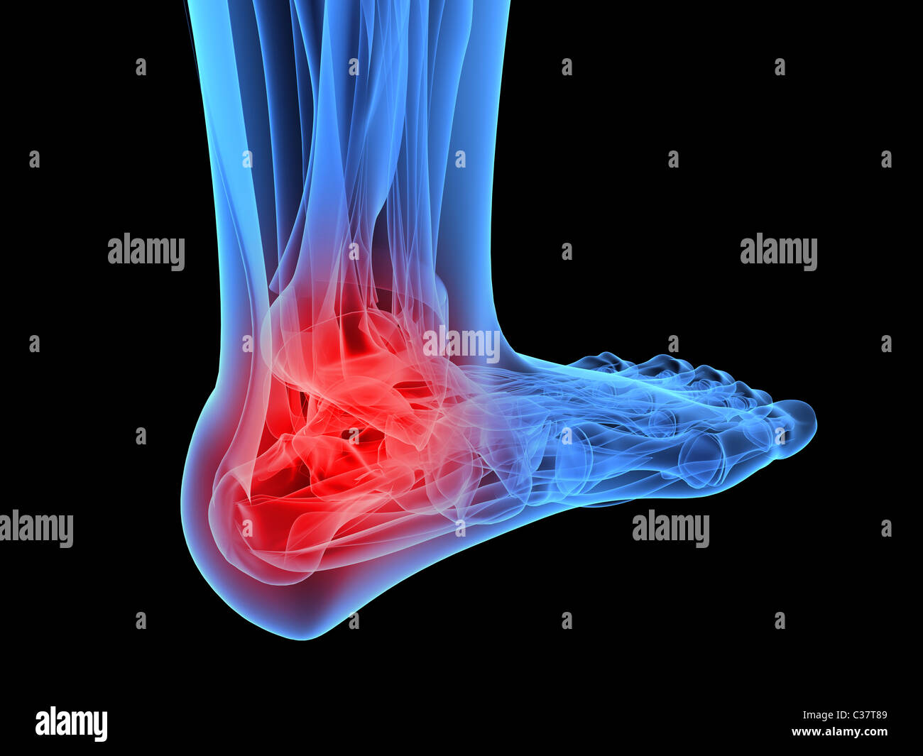 x-ray foot - painful ankle Stock Photo