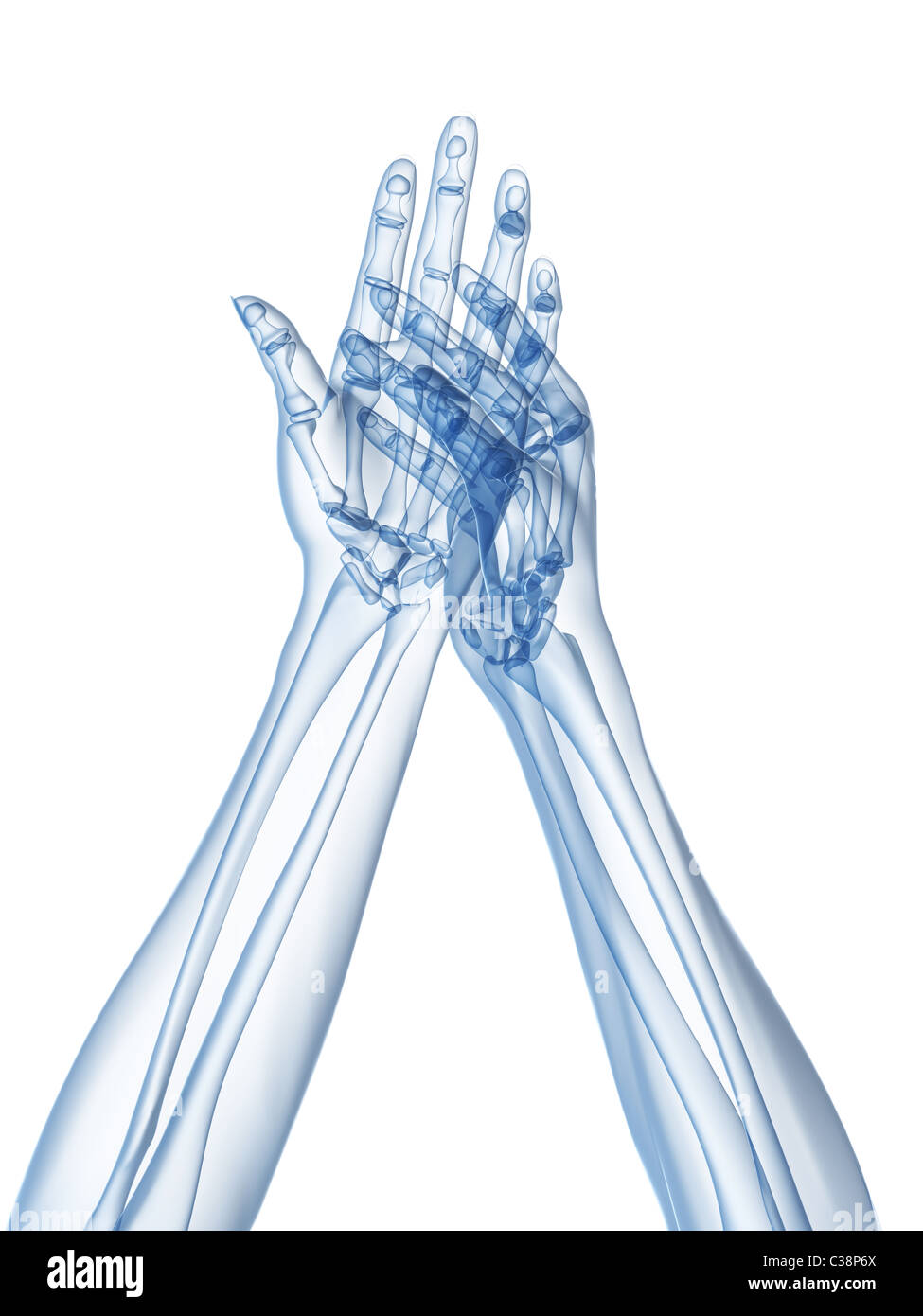 x-ray hands - arthritis Stock Photo
