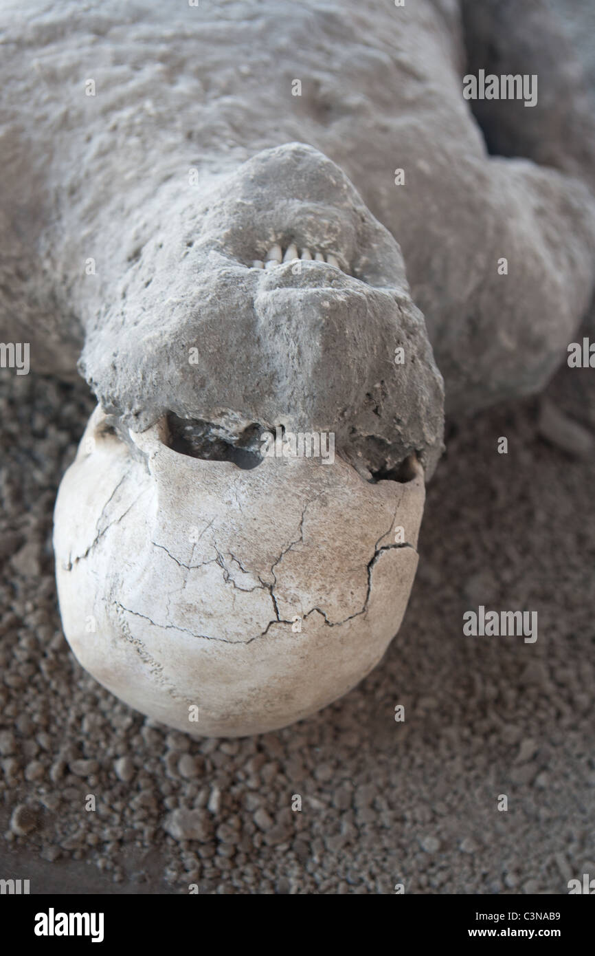 Cast of roman killed in the Vesuvius erruption of AD 79. Bones and teeth clearly visible. Pompeii, Italy. Stock Photo