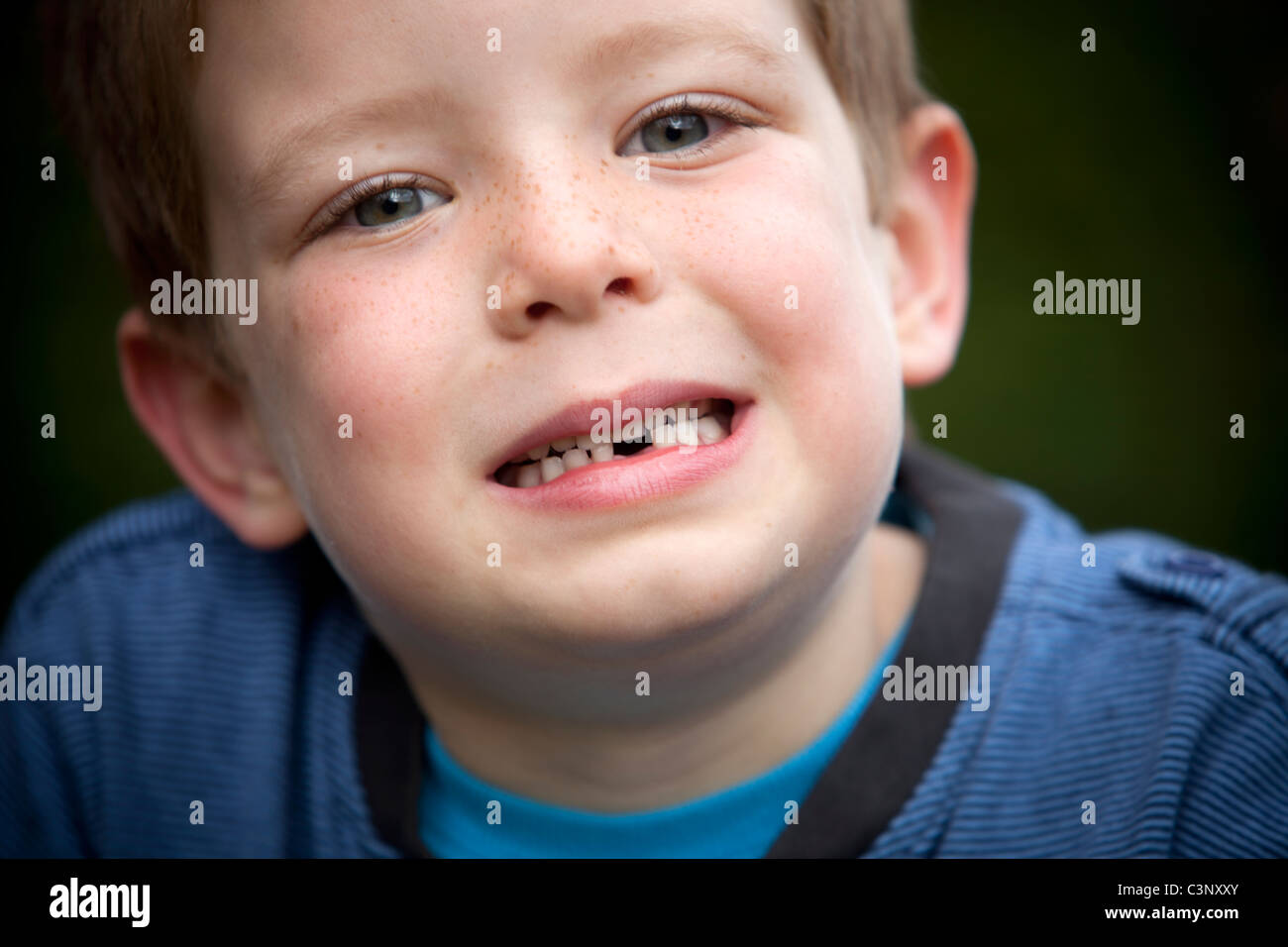 A young boy shows off his missing front tooth. Stock Photo