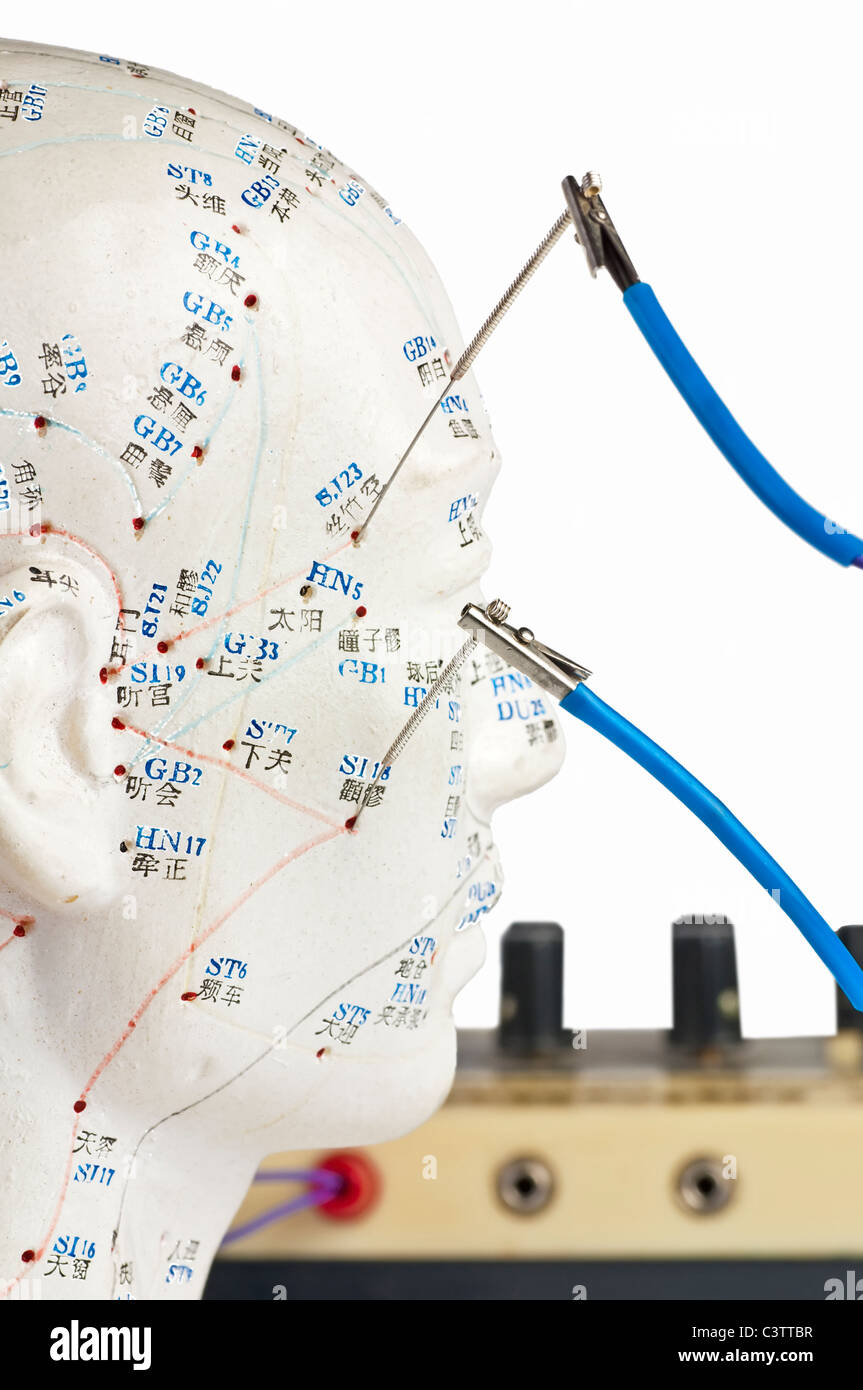 Electro acupuncture hires stock photography and images Alamy