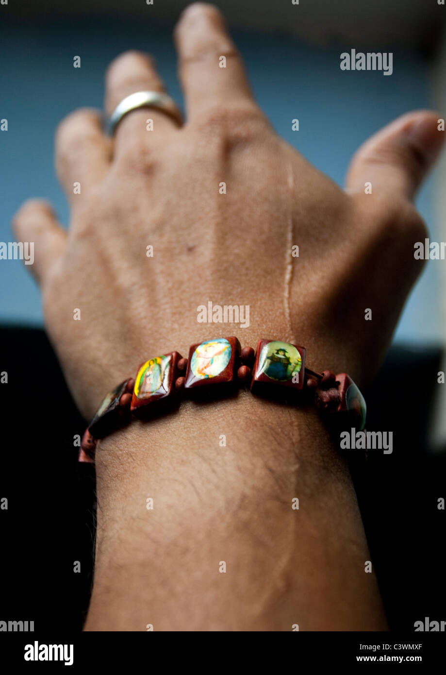 Scarred man's hand, wearing a religious wooden bracelet and a ring Stock Photo