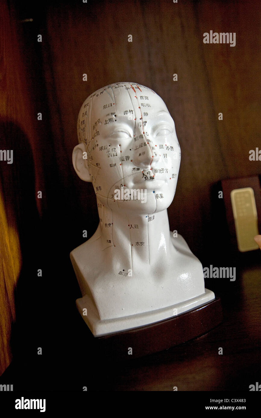 China,Shu Guang Hospital. AffilIiated to Shanghai University of TCM (Traditional Chinese Medecine).The energy lines of the head. Stock Photo