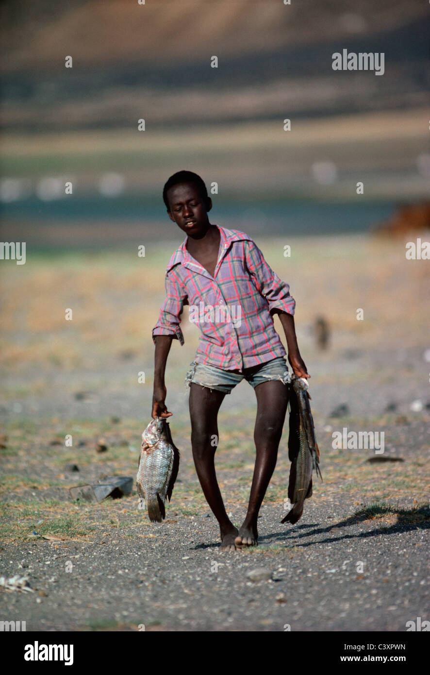 El Molo child suffering from Rickets. Stock Photo