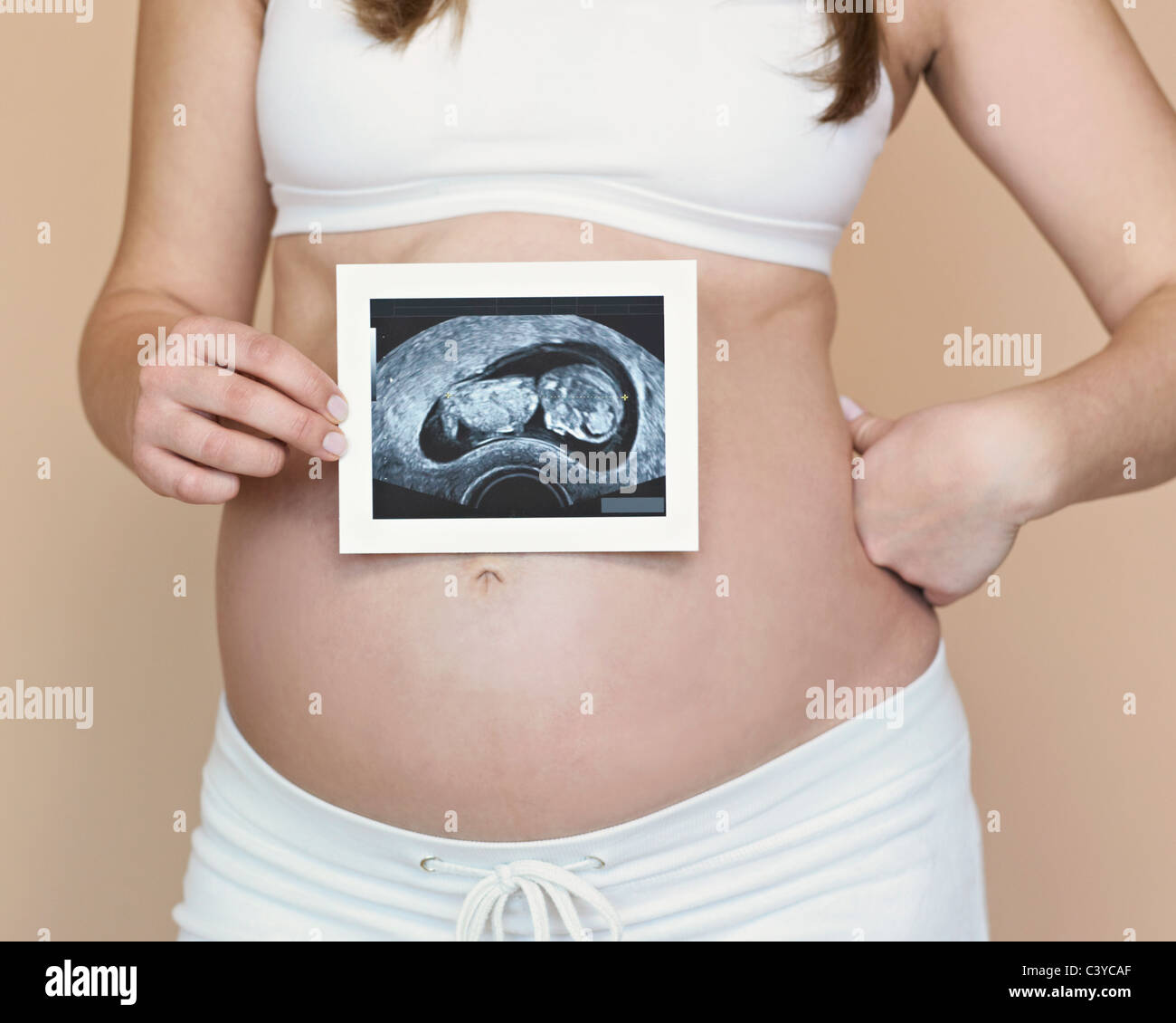 перинатальный скрининг. узи. узи беременных. скрининг беременных. ультразвуковой скрининг.