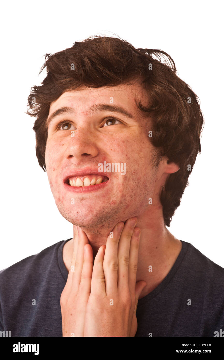 A young adult man with bad complexion, rubbing his throat, worried