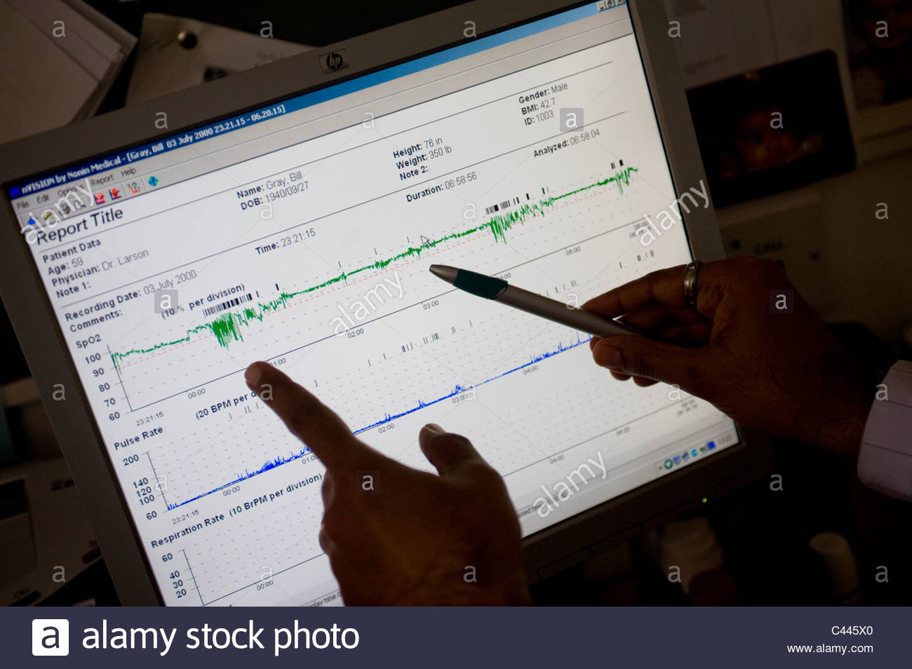 O2 Sat Monitor Chart Oxygen Saturation Stock Photos & Oxygen Saturation Stock Images - Alamy