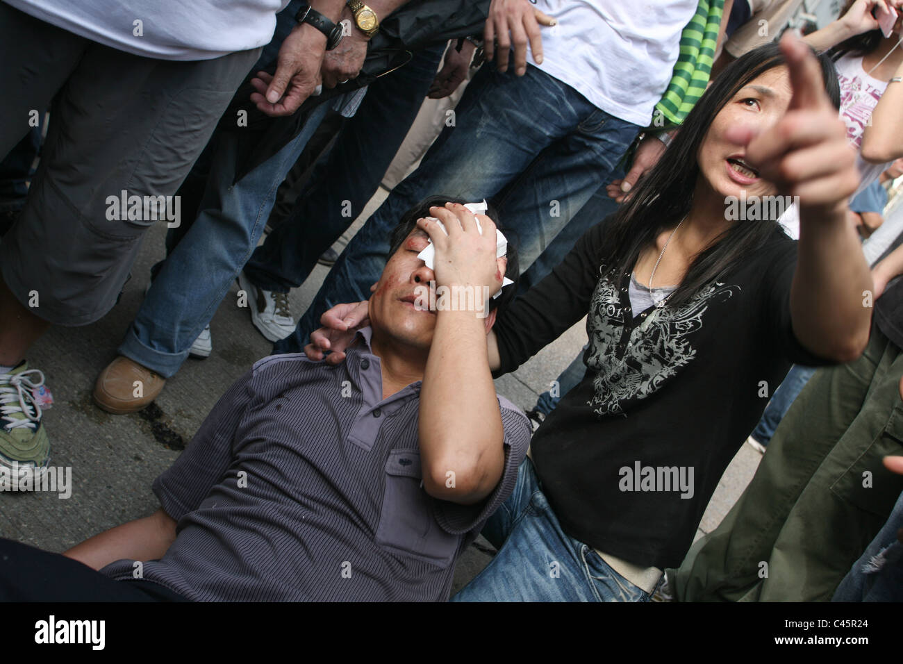 Man bleeding and hurt in a street protest, demonstration, Macau Stock Photo