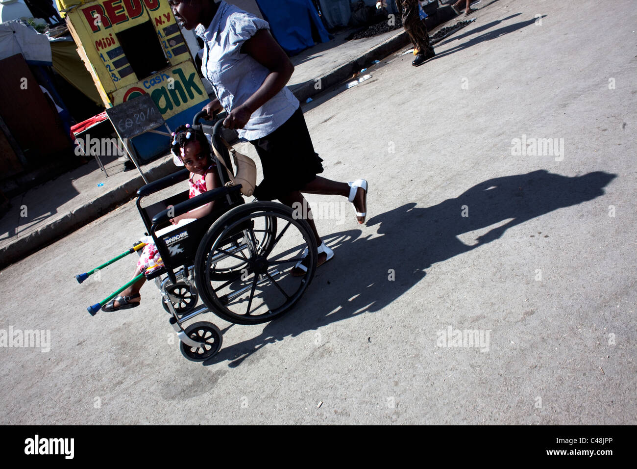 Little girl who lost her leg is being carried in a wheel chair Stock