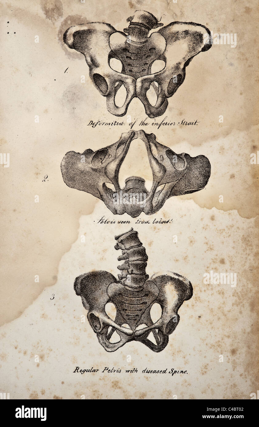 Illustration of the Human Pelvis copyright 1844 Stock Photo - Alamy
