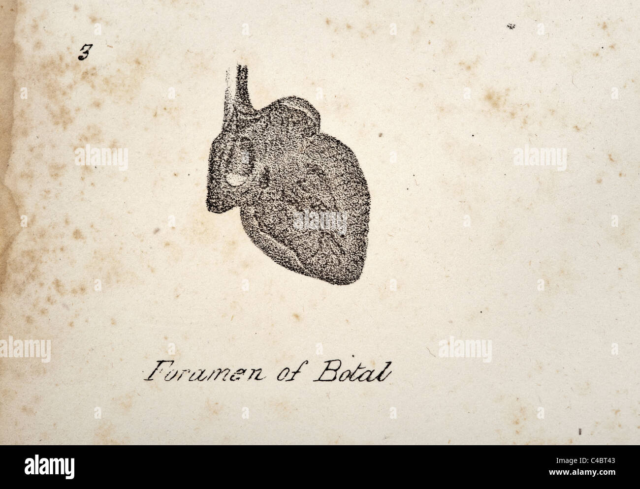 Fetal heart hi-res stock photography and images - Alamy