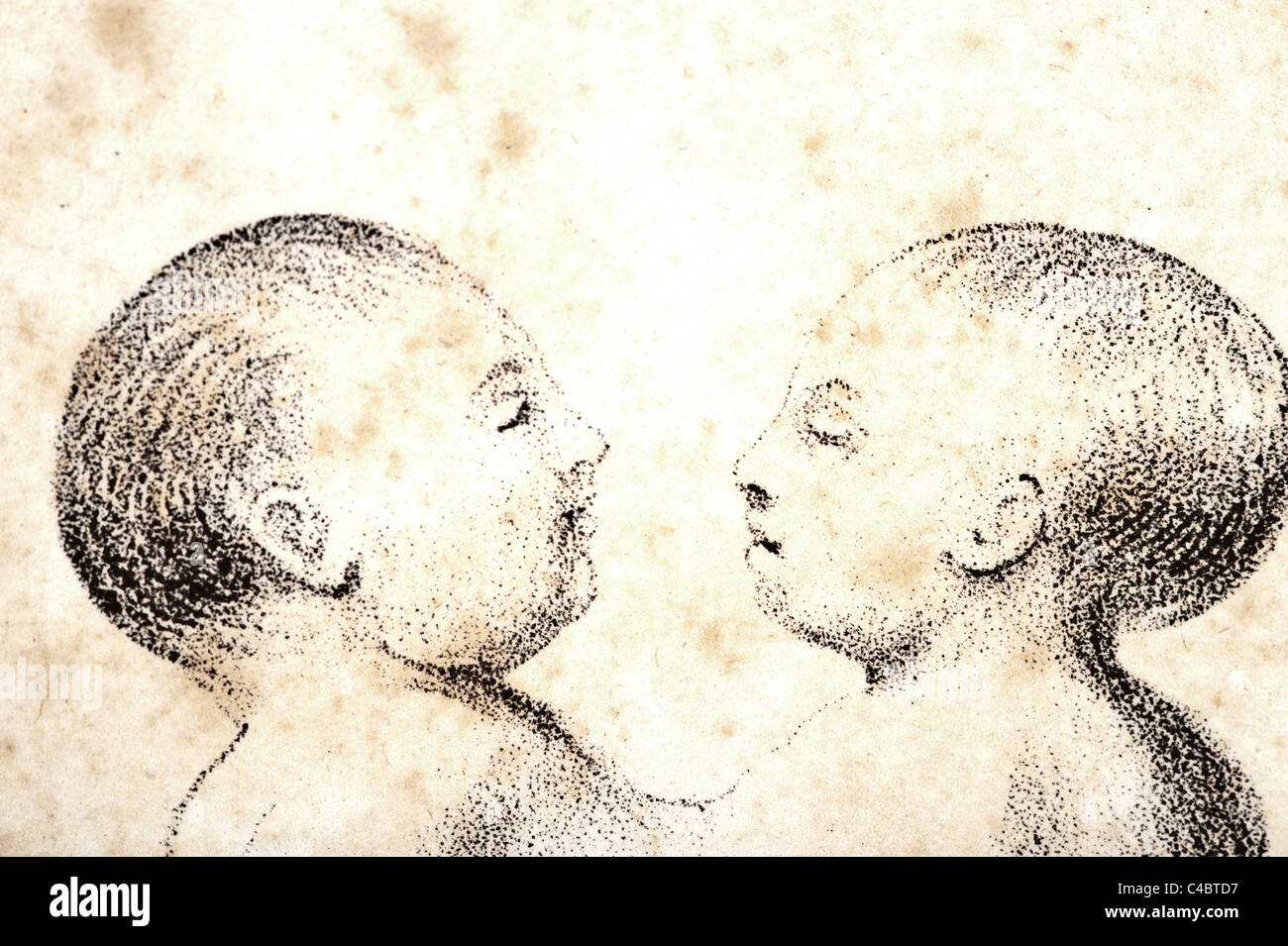 Illustration of Human Conjoined Twins copyright 1844 Stock Photo