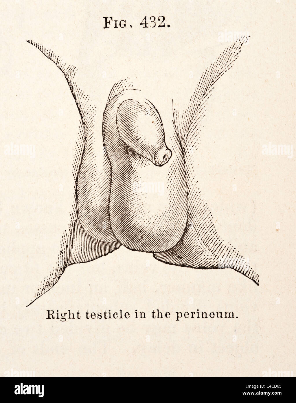 Antique Medical Illustration of the Penis circa 1881 Stock Photo - Alamy