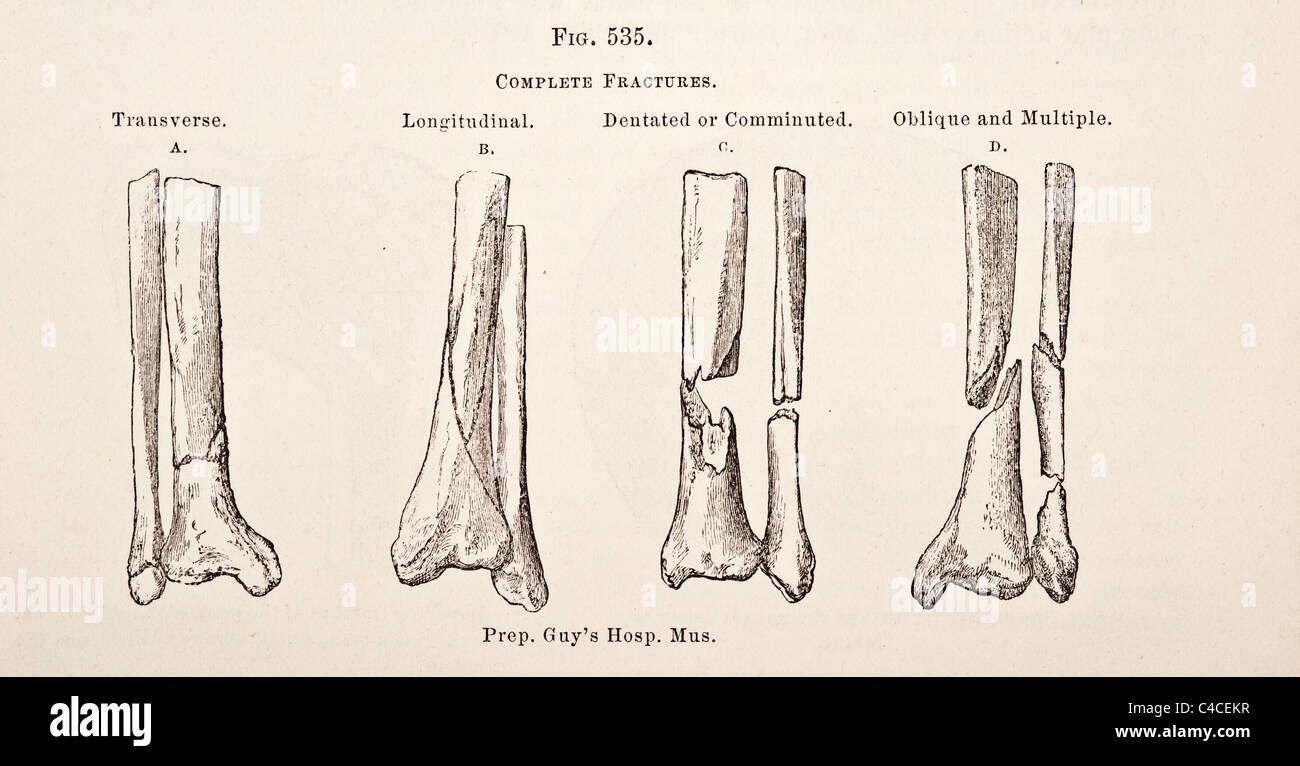 Brittle fracture hires stock photography and images Alamy