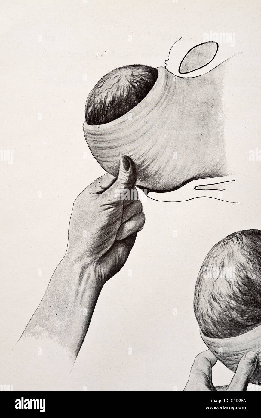 Birth Canal Illustration High Resolution Stock Photography and Images ...