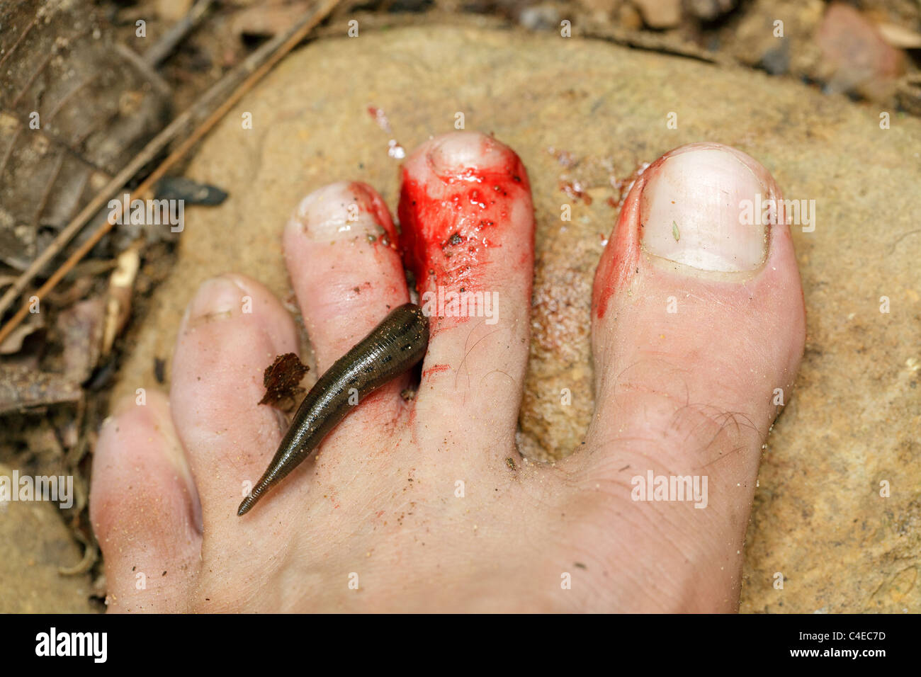 tropical leech biting human foot in asian rainforest Stock Photo - Alamy