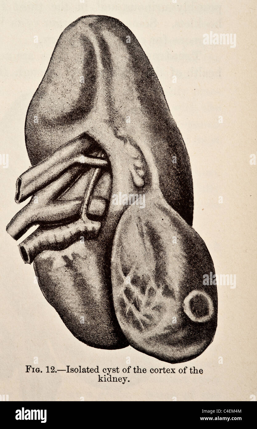 Genito-Urinary Diseases Syphilology and Dermatology copyright 1893 Stock Photo