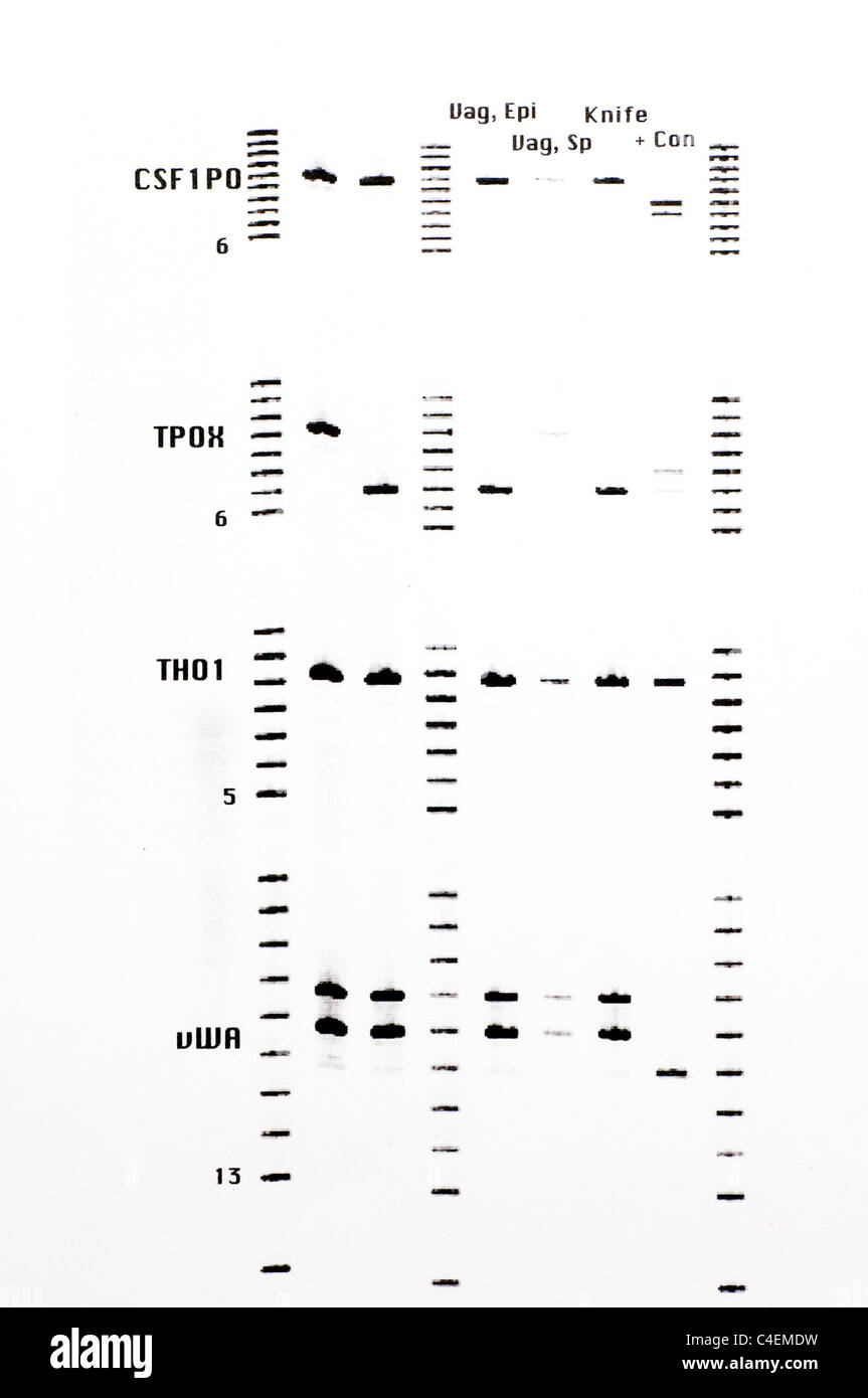 Forensic DNA results with STR analysis of samples. Stock Photo