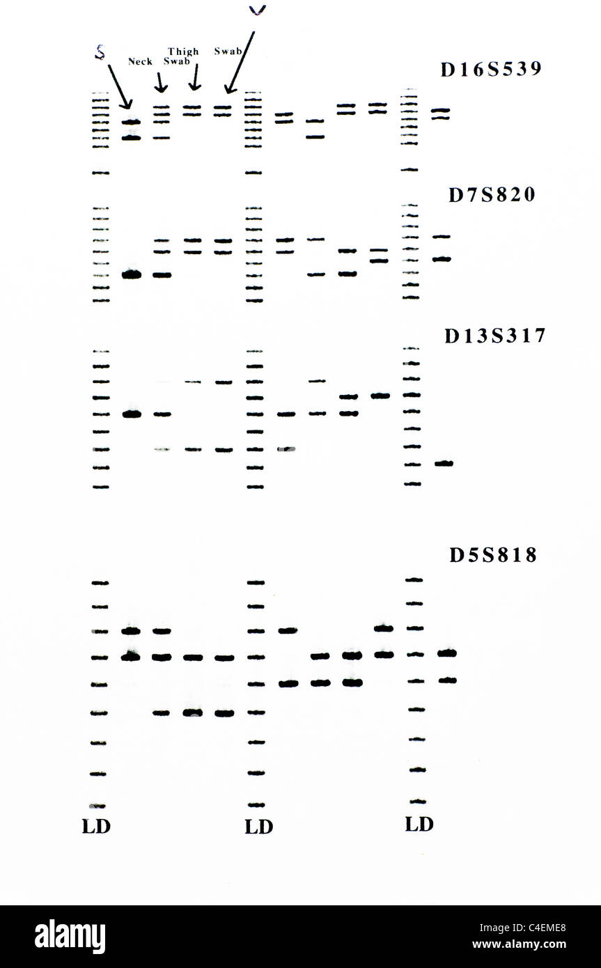 Forensic DNA results with STR analysis of samples. Stock Photo