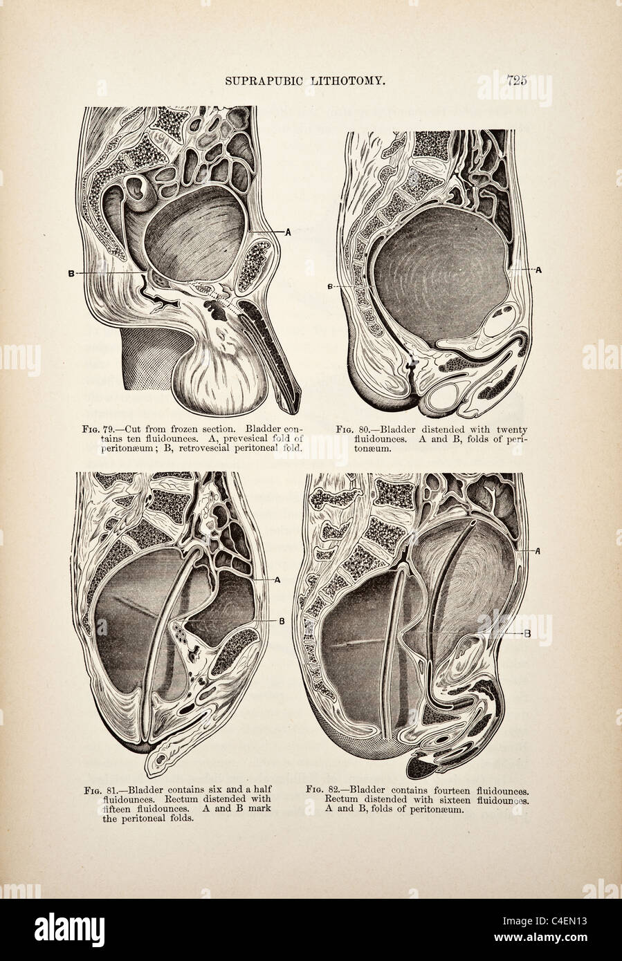 Genito-Urinary Diseases Syphilology and Dermatology copyright 1893 Stock Photo