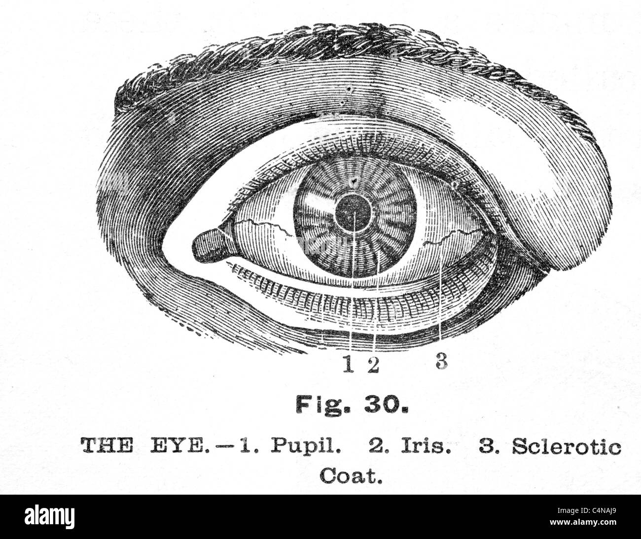 Antique medical illustration of eye disease and Ophthalmologic surgery