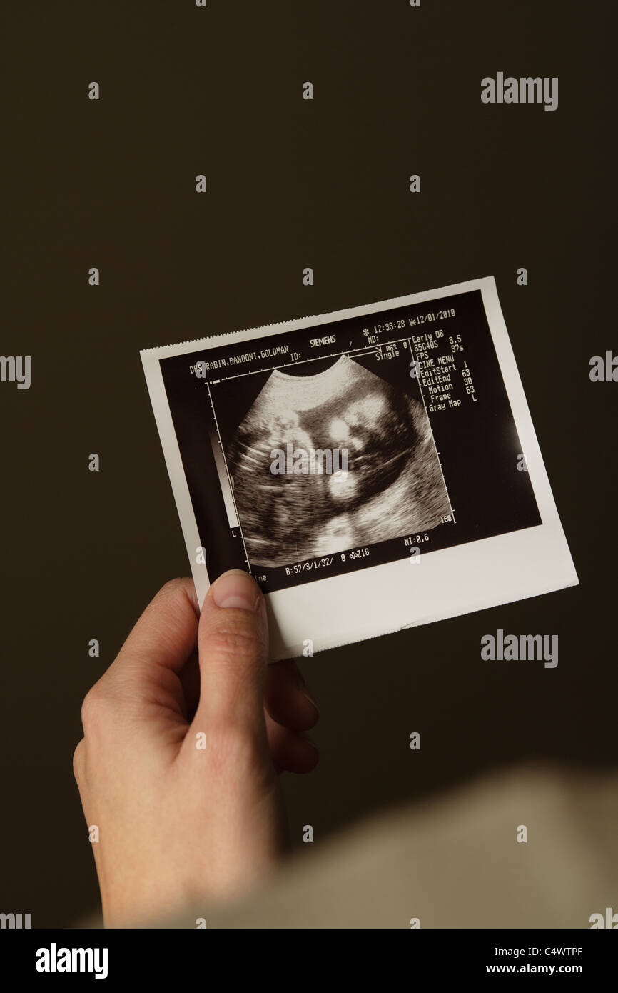 Ultrasonograph hi-res stock photography and images - Alamy