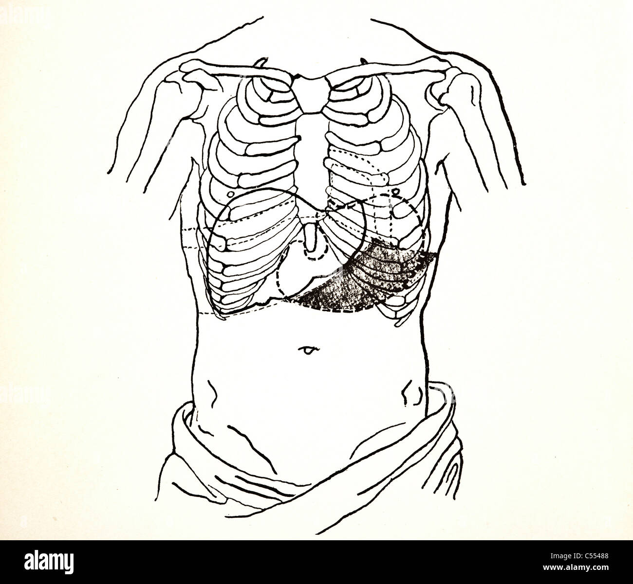 Antique medical illustration of the ribs and abdomen Stock Photo - Alamy