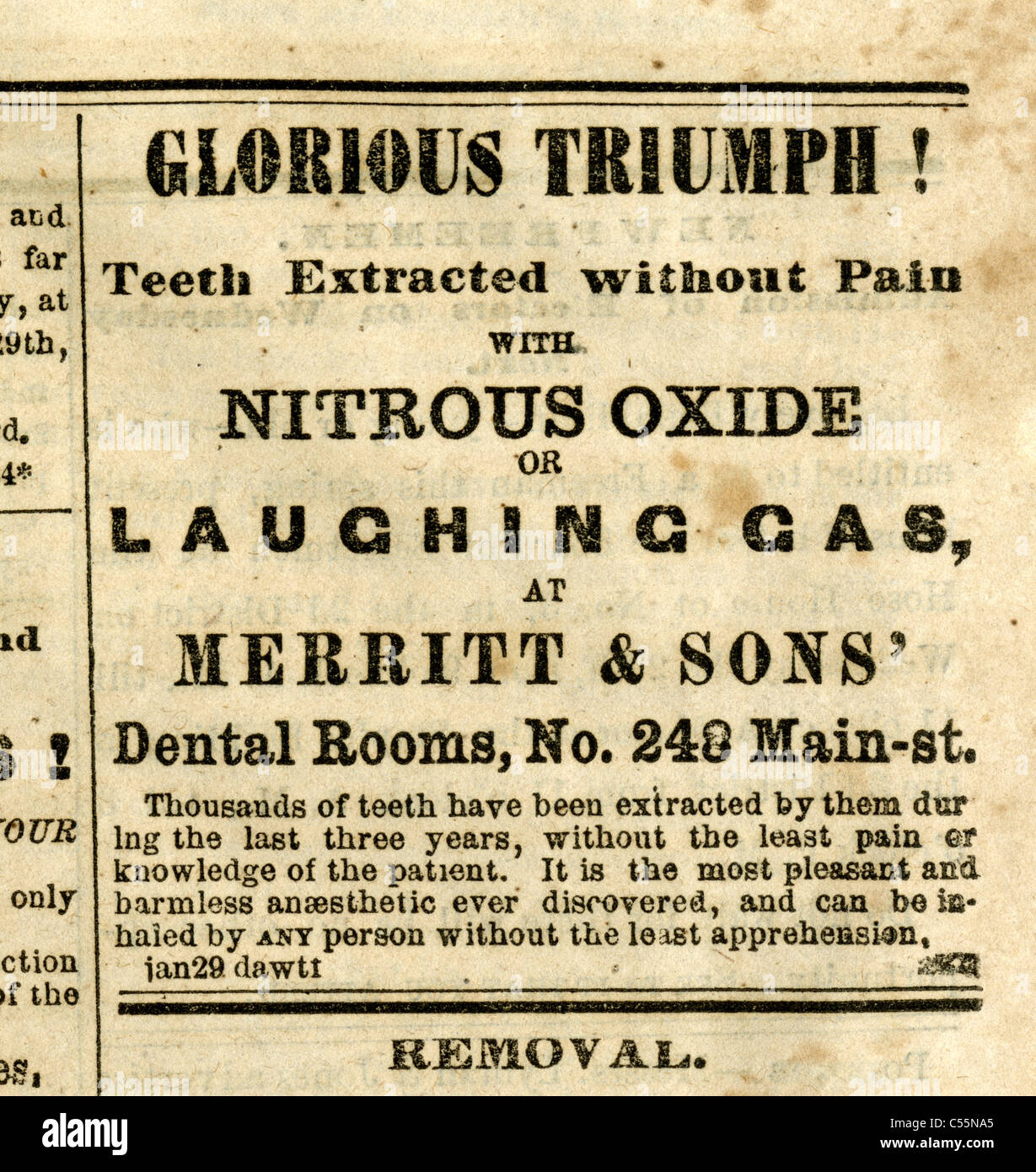 1867 engraving, 'Glorious Triumph! Teeth Extracted without Pain with Nitrous Oxide or Laughing Gas.' Stock Photo