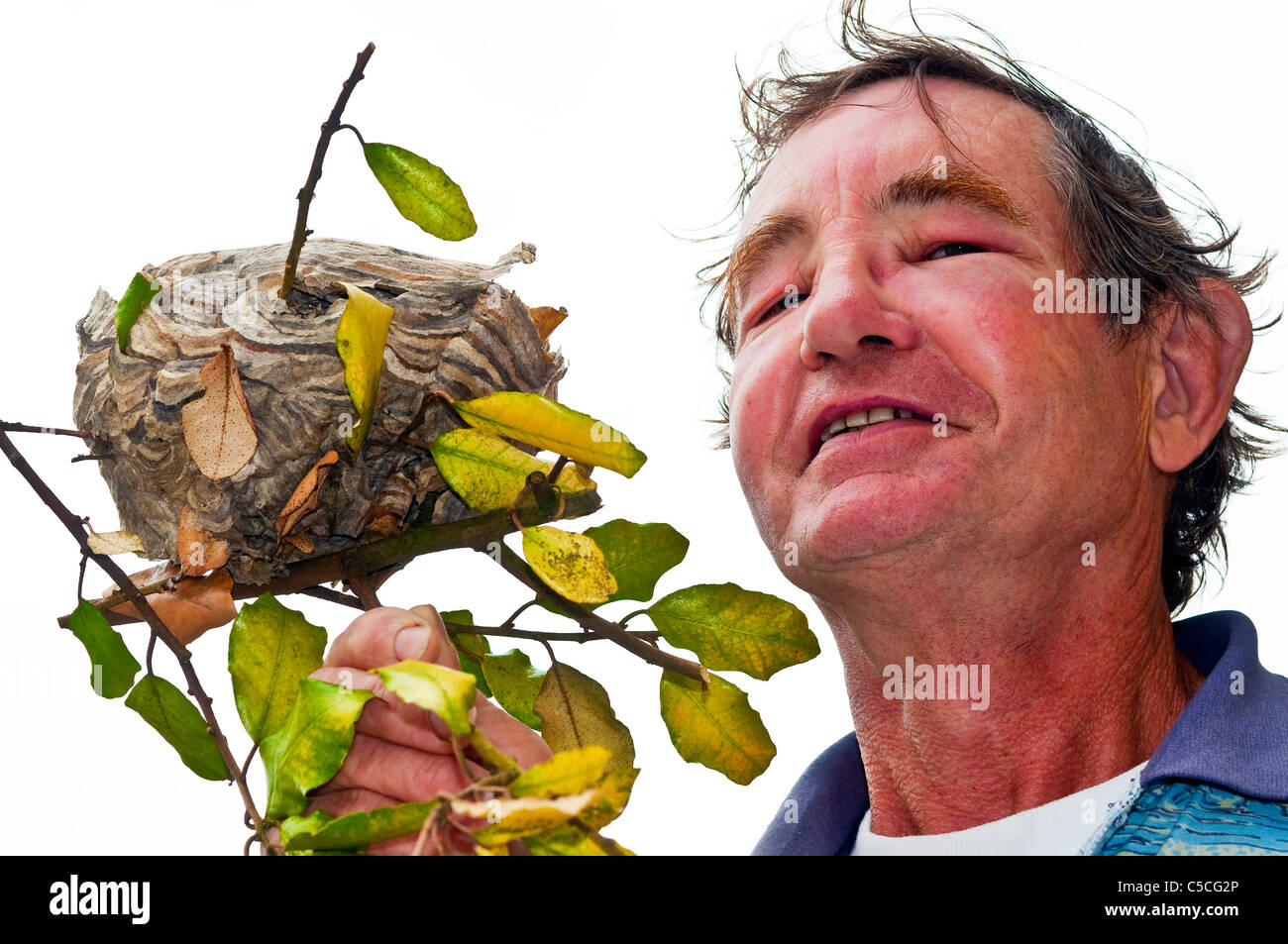 Man with wasp stings / swollen face holding wasp's nest - France. Stock Photo