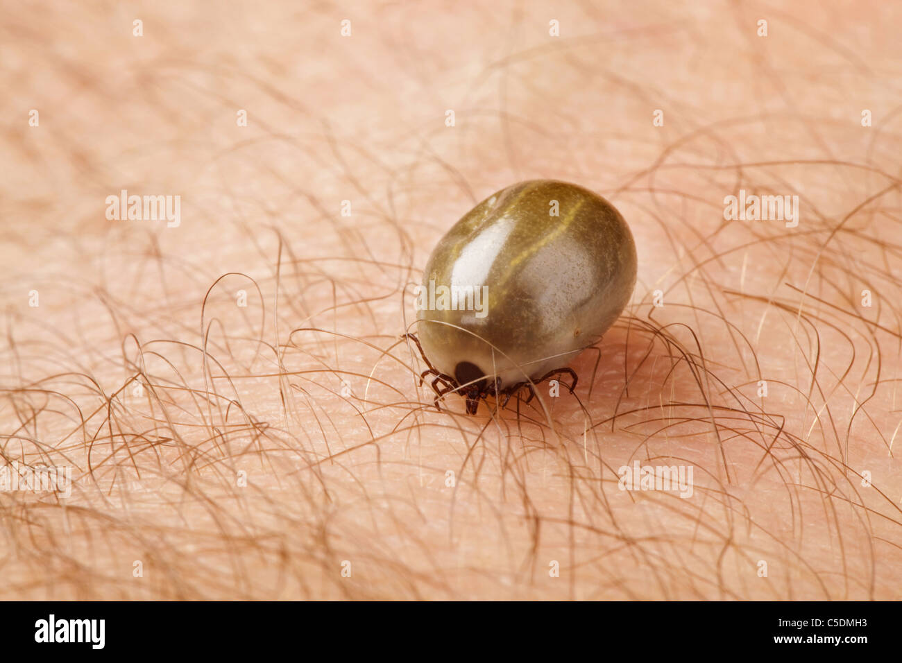 Single well-fed tick on human skin Stock Photo