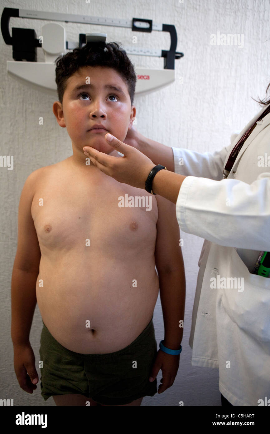childhood obesity in Mexico Stock Photo