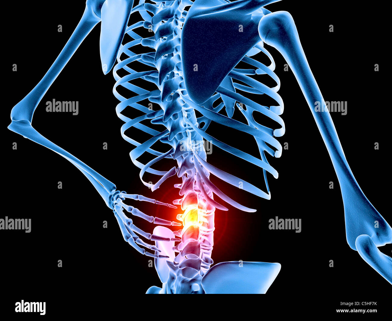 Back pain Stock Photo