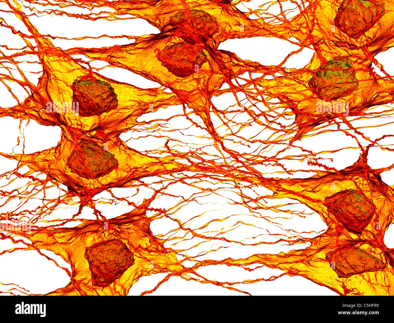 Tumour cells Stock Photo