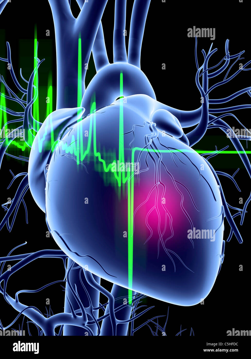Heart attack and ECG trace Stock Photo Alamy