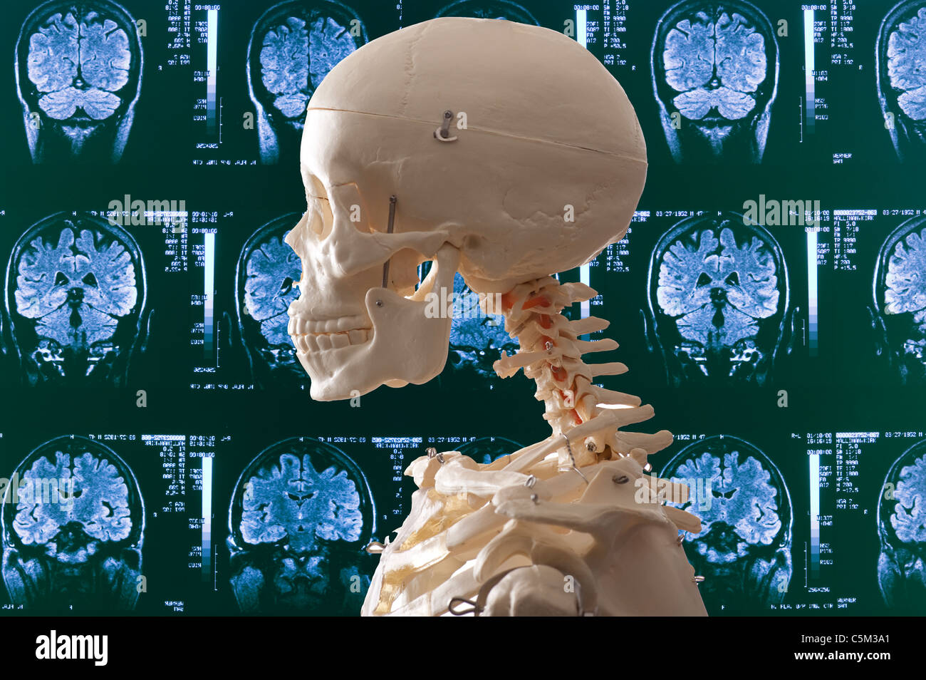 human skeleton and medical MRI background Stock Photo