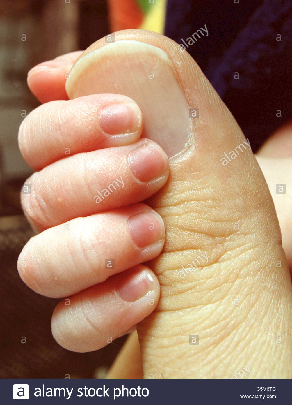 newborn fingernails